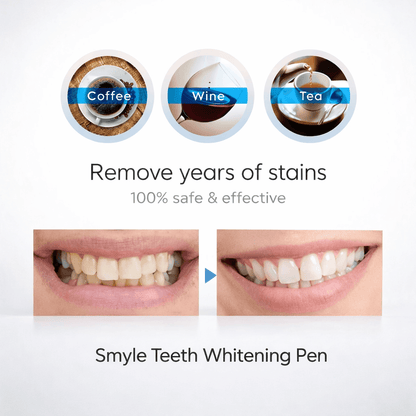 Smyle - Teeth Whitening Pen